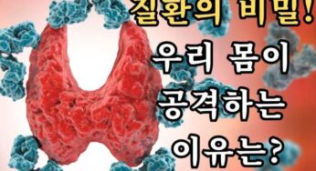 자가면역 질환의 비밀! 우리 몸이 공격하는 이유는?