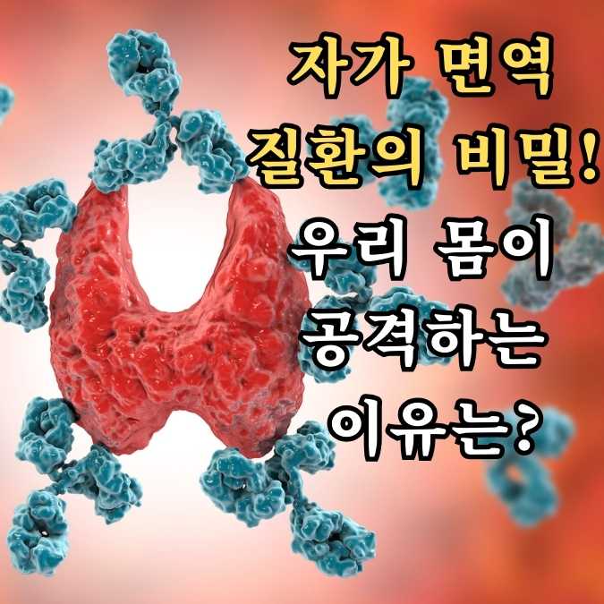 자가면역 질환