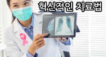 유방암 생존률 향상을 위한 혁신적인 치료법 소개