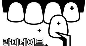 자신감 넘치는 웃음을 만드는 라미네이트의 모든 것